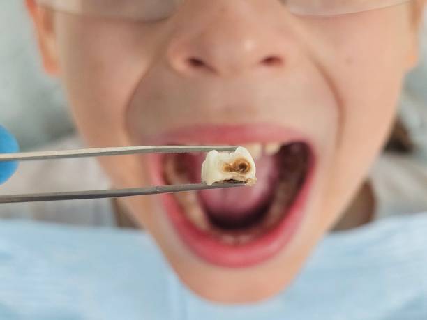 Best Emergency Care for Gum Disease in Sea Bright, NJ